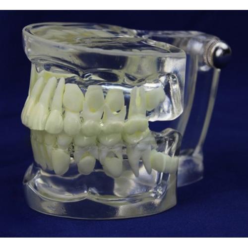 ENOVO®乳歯から永久歯に生え変わる時期の透明模型-小児歯科模型