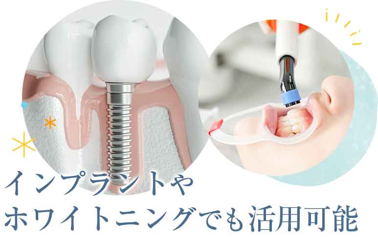 光加速装置PBM | 武蔵小杉まつ歯科クリニック 川崎市中原区の歯医者