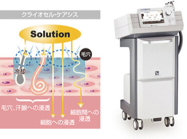 エレクトロポレーションの施術 | 銀座の美容外科・美容皮膚科なら