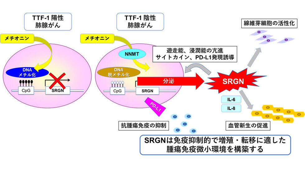 肺腺がんにおいて高悪性化をきたすメカニズムを解明 ～予後不良なサブ