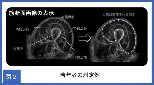 広範囲の筋肉が映し出される、携帯可能な筋肉専用超音波測定装置が臨床