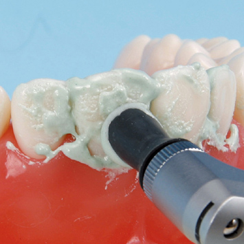 SRP用顎模型 [D16HD-500H(GSF)-MF](咬合器なし)｜株式会社ニッシン