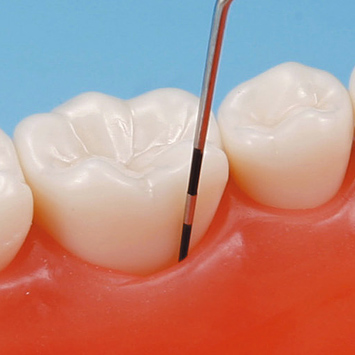 SRP用顎模型 [D18D-500H(GUB)-MF](D咬合器つき)｜株式会社ニッシン