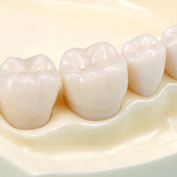 SRP用顎模型 [D18HD-500H(GUB)-MF](咬合器なし)｜株式会社ニッシン