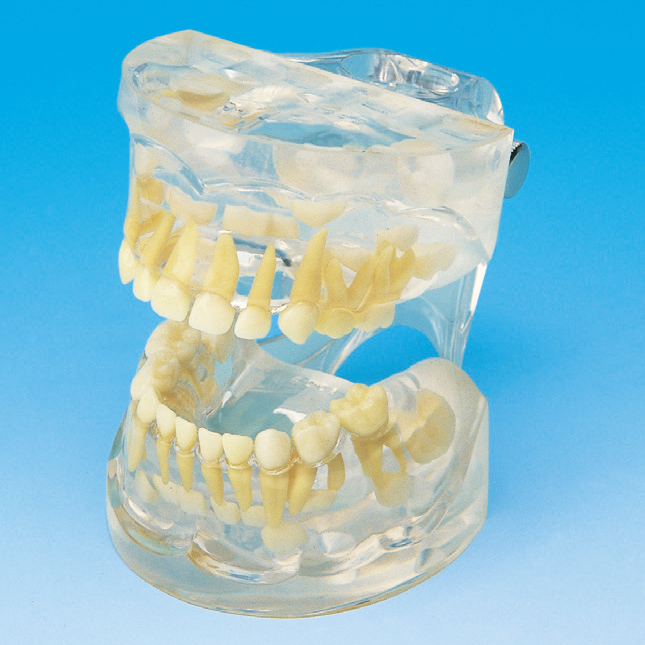 透明歯列発育模型 [PE-PDI001(P12P-100B)]｜株式会社ニッシン｜歯科