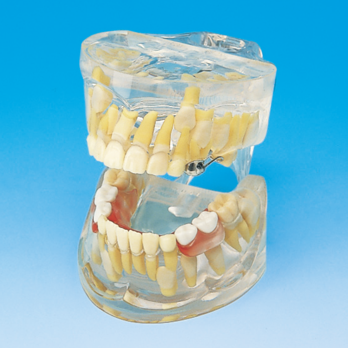 透明歯列発育模型 [PE-PDI003(P12P-100C)]｜株式会社ニッシン｜歯科