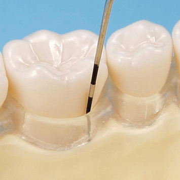 SRP用顎模型 [D16D-500H(GSD)-MF](D咬合器つき)｜株式会社ニッシン