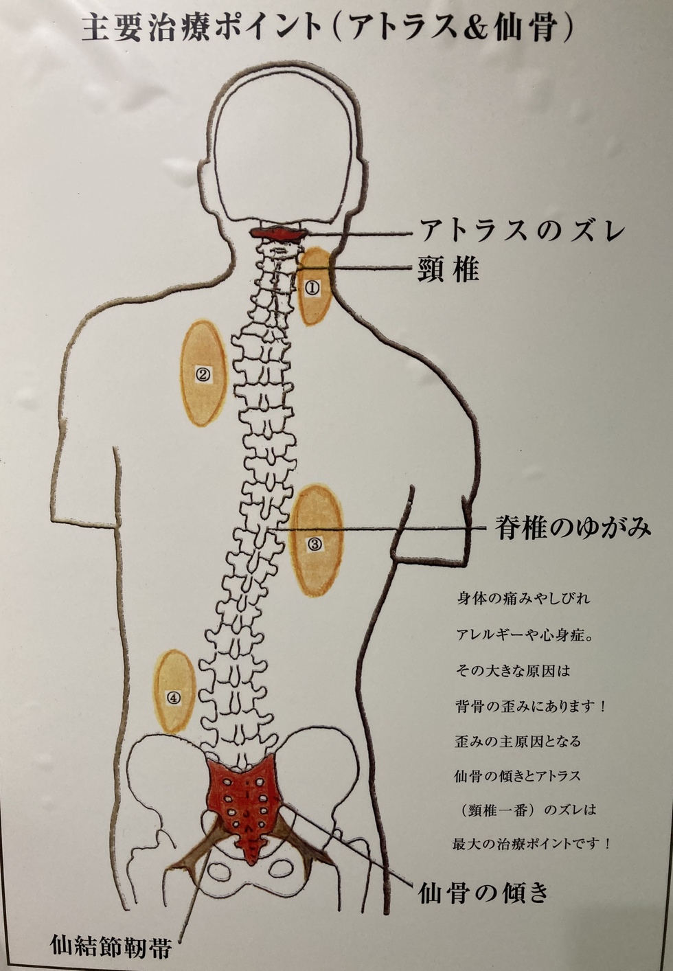 ソフトカイロ（SOT） - 枚方市宮之阪の整体 中央カイロプラクティック