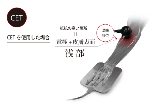 フィジオ ラジオスティム プロ | 酒井医療株式会社