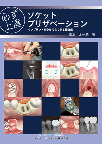 必ず上達 ソケットプリザベーション インプラント初心者でもできる骨