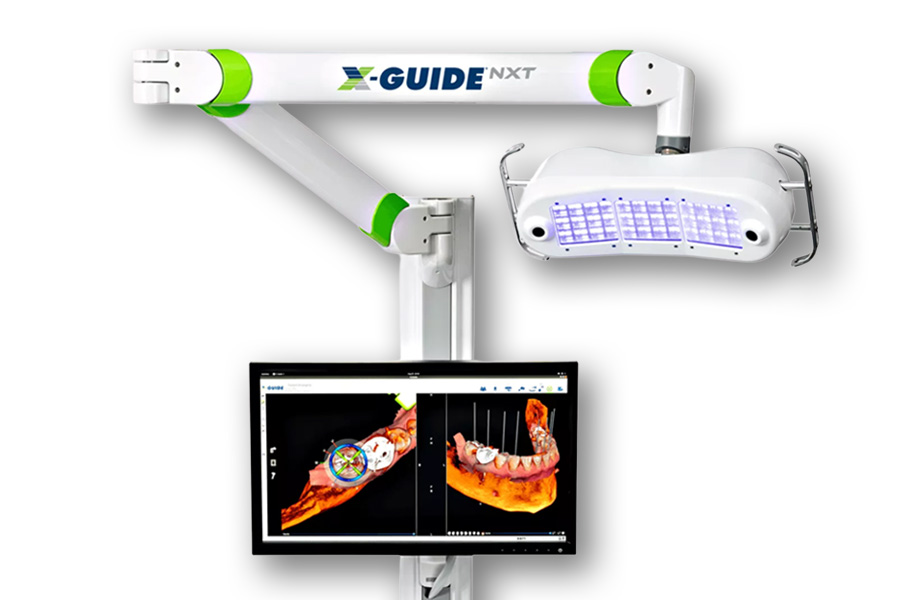 エックスガイド(X-Guide)とは？安全なインプラントに欠かせないガイド