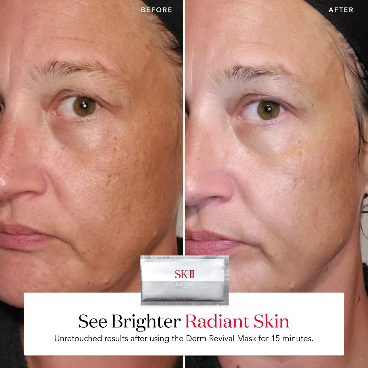 Brightening Derm Revival Mask - SK-II | Sephora