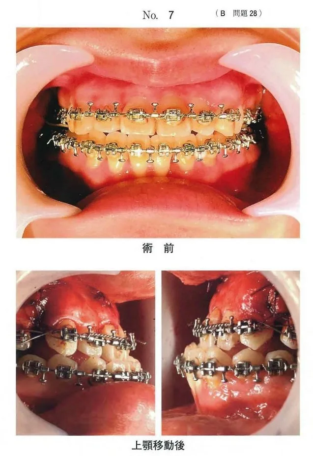 歯科矯正学 | 歯科国試ドットコム