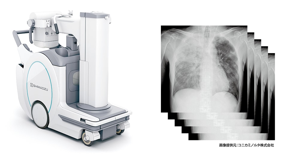 SHIMADZU] 回診用X線撮影装置に連続撮影機能を搭載 移動困難な患者に