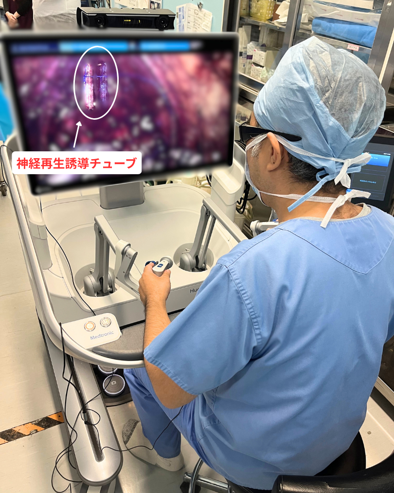 ロボット支援前立腺全摘術時の勃起神経再生誘導術 初症例 | 新松戸中央