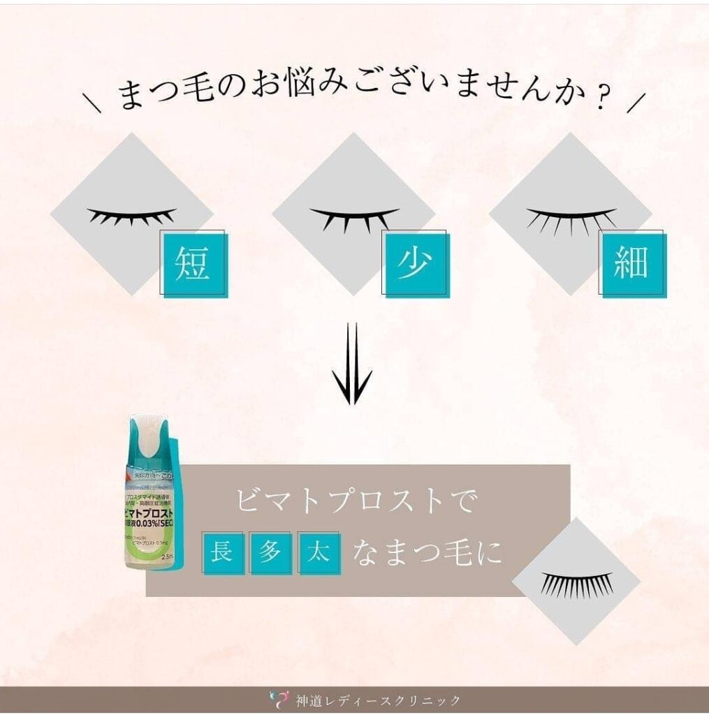 まつげ育毛〗ビマトプロストのお取り扱い始まりました！ | 大阪府門真