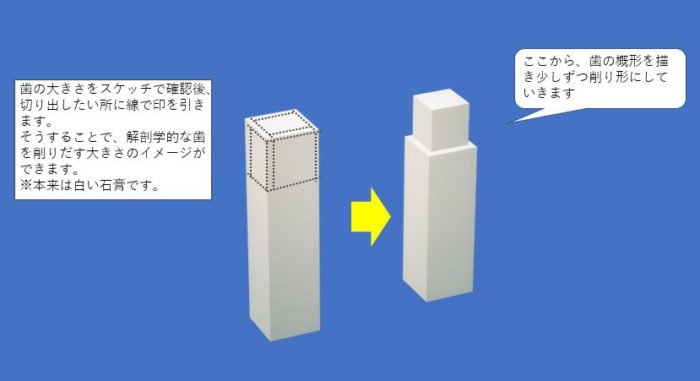 歯型彫刻実習 歯科衛生科2年生 - 専門学校仙台総合医療大学校