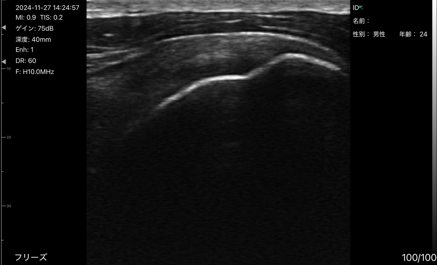 汎用超音波画像診断装置ポケットエコー miruco CL5