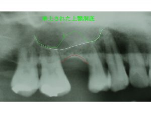 131578614b787d6411b449b59efa1e