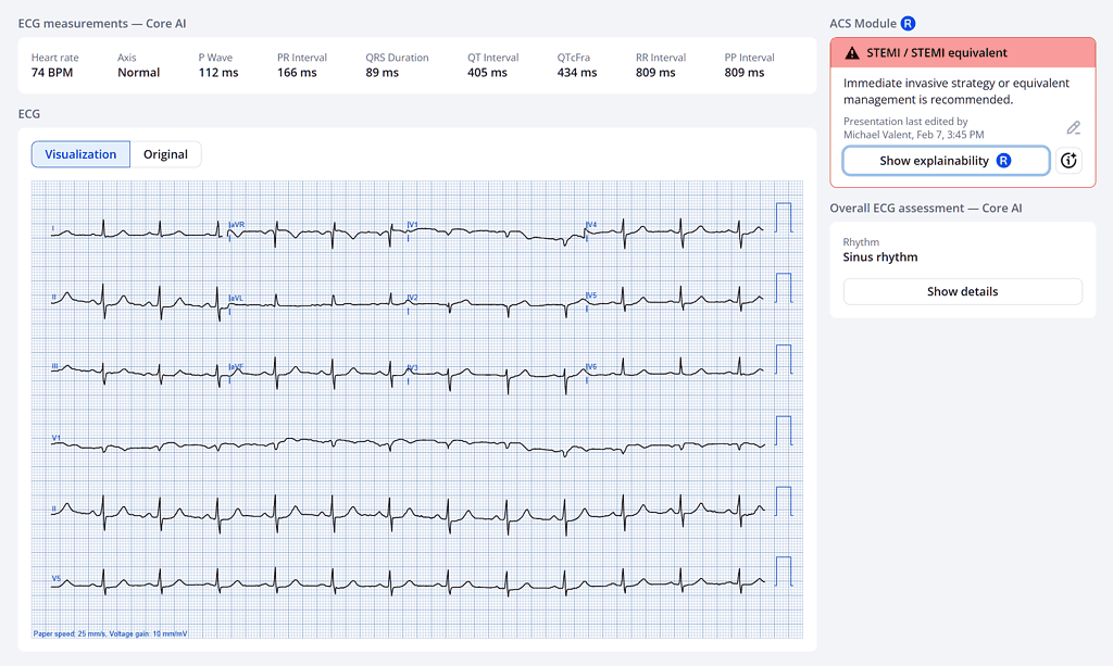 ECG Explainability in PMcardio: Human-Centered AI