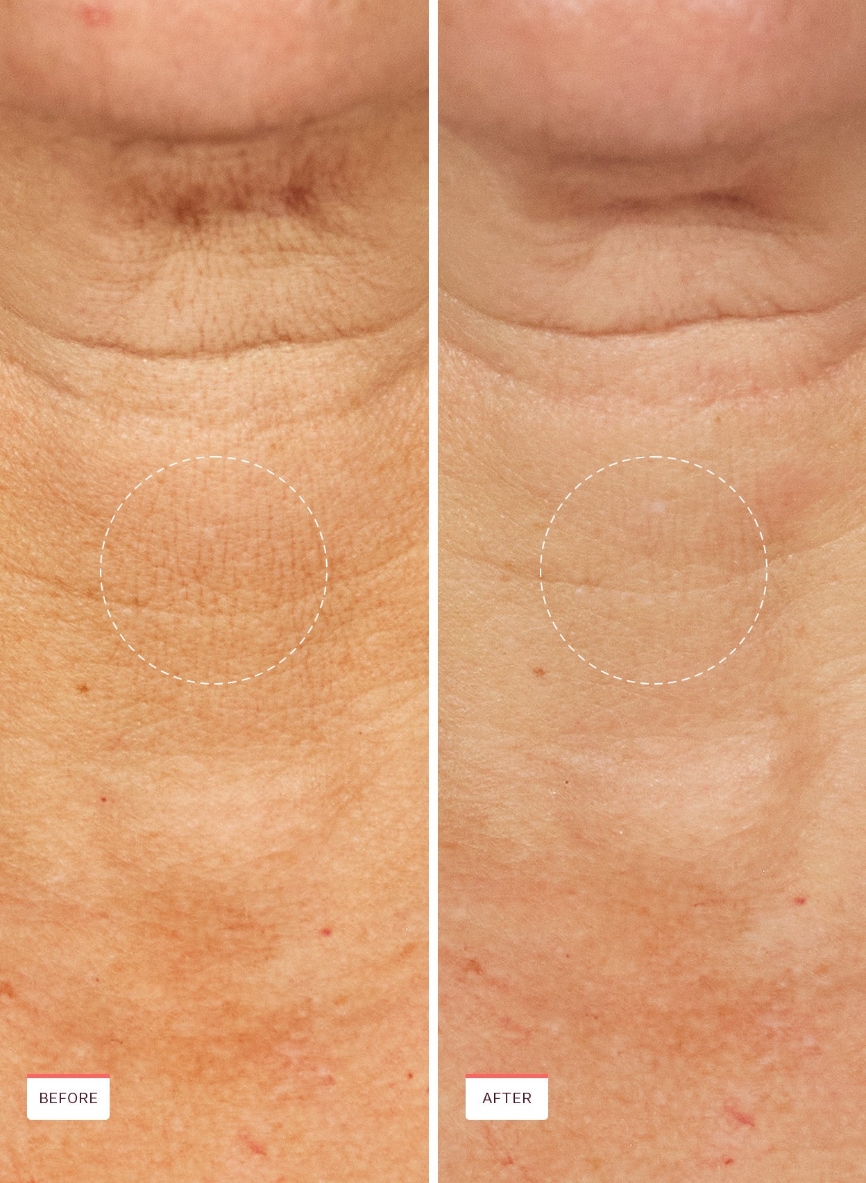 Power Cocktail Lactic Acid Repair Serum for Face - Korean