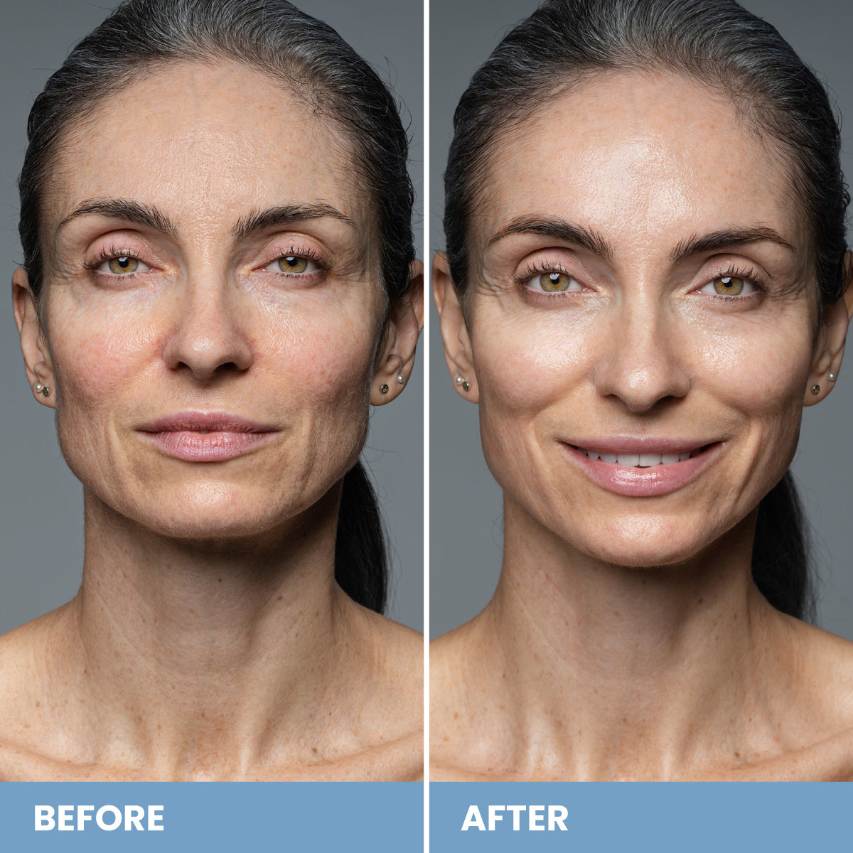 Miracle Cream | PrimePrometics™