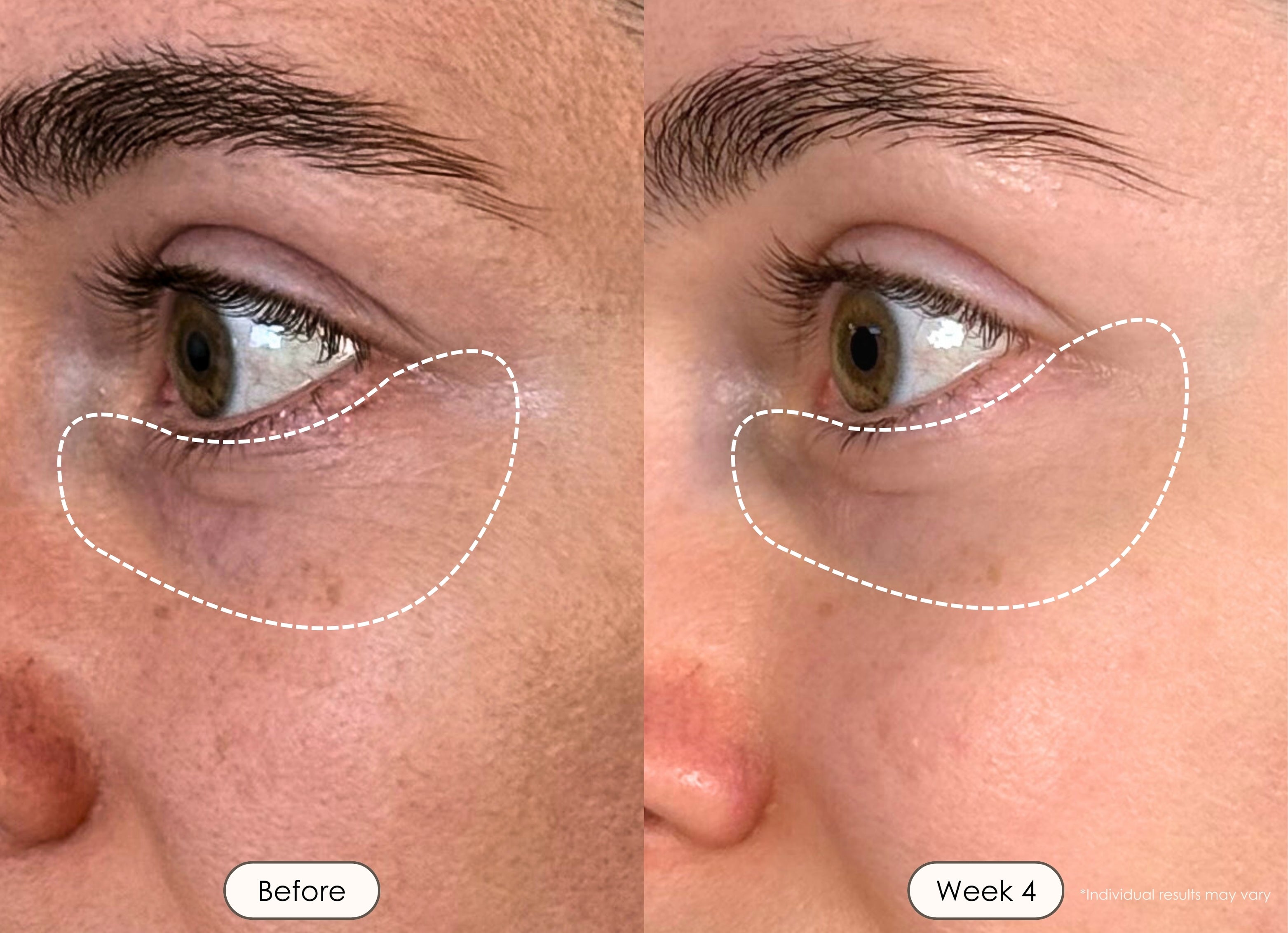 Empowering Your Skin Journey | LED Light Therapy | Project E Beauty