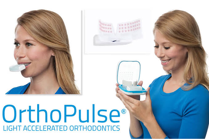オルソパルス〜光加速矯正〜｜Esca BLOG｜名古屋駅すぐのエスカ歯科