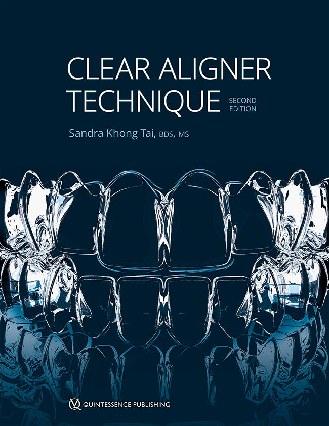 Clear Aligner Technique | Sandra Khong Tai | Quintessence