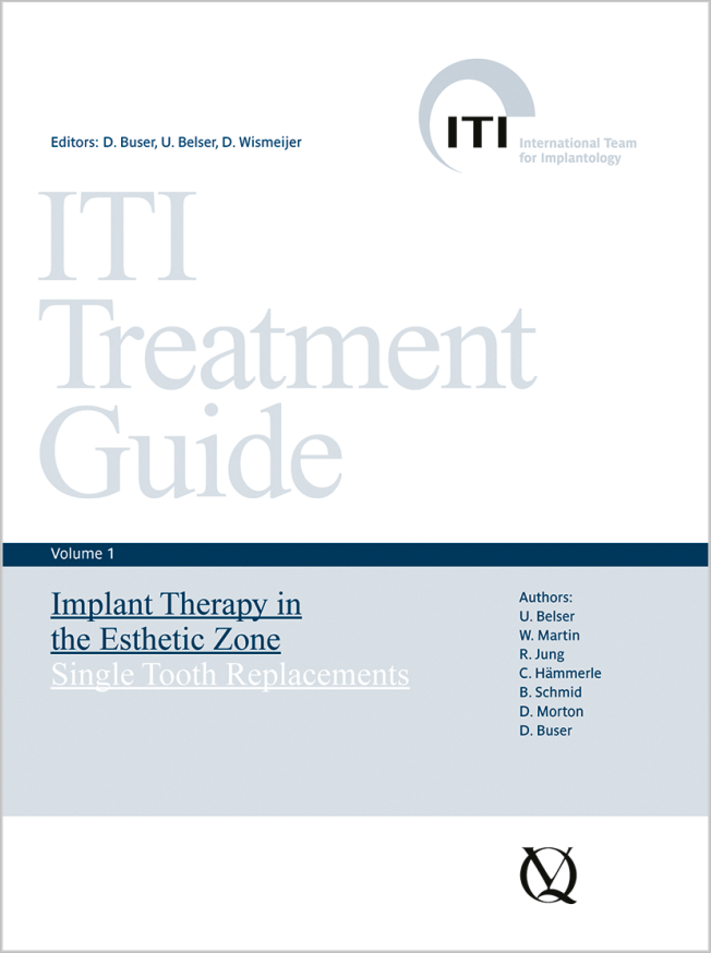ITI Treatment Guide Series | Quintessence Publishing USA