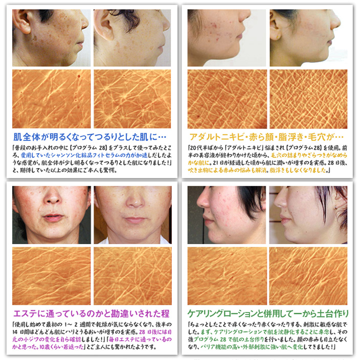 アクアベース楽天市場 シャンソン化粧品＜プログラム28＞