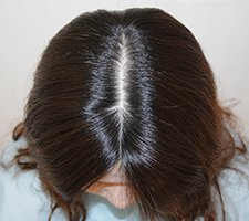 公式】発毛専門 リーブ21