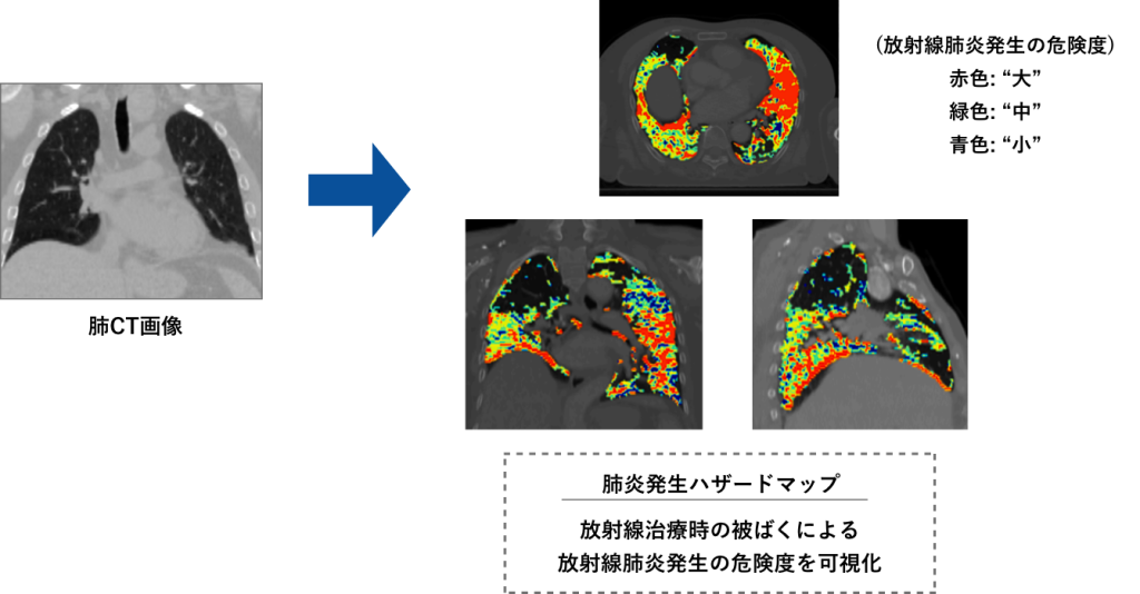 研究紹介 – 東北大学大学院医学系研究科 放射線腫瘍学分野 医学物理