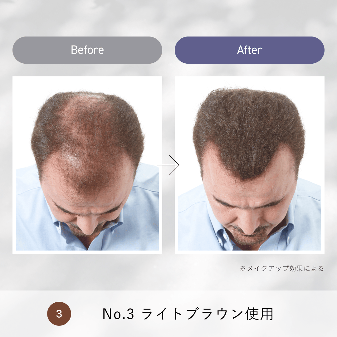 ルアン公式オンラインショップ /スーパーミリオンヘアー ミニセット