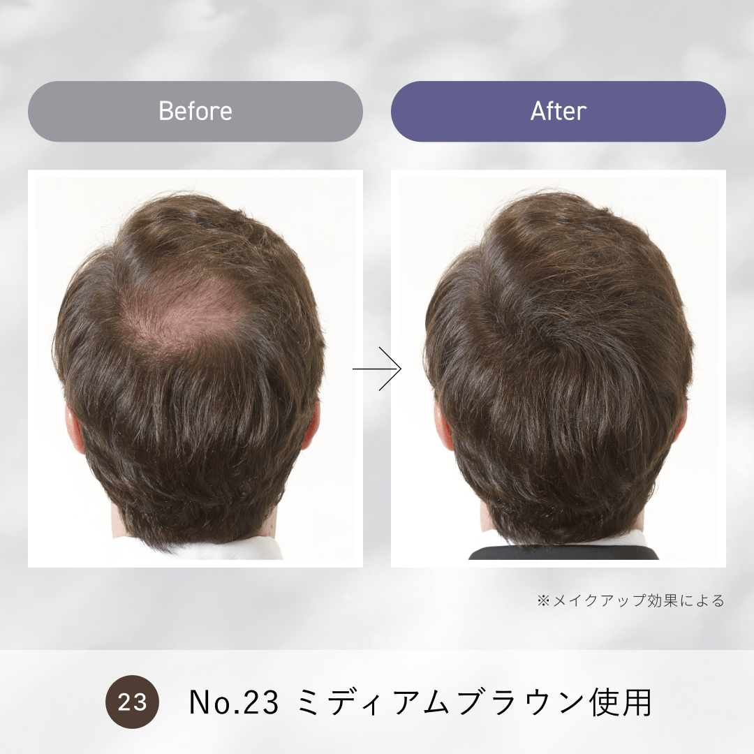 ルアン公式オンラインショップ /スーパーミリオンヘアーコンパクトセット