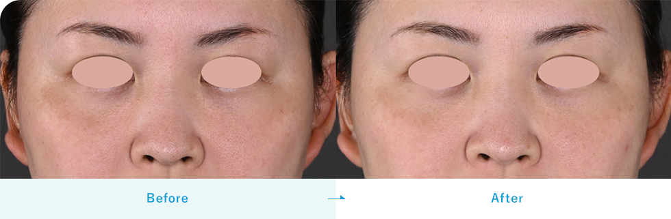 TXA濃縮美容液（ダームエデン）｜内服・外用薬・その他商品なら湘南