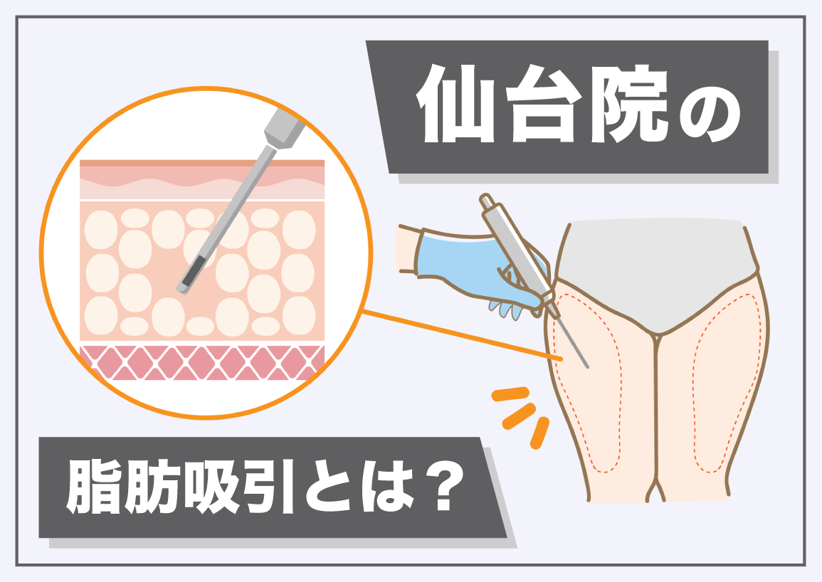 脂肪吸引するなら】施術の魅力と仙台院のこだわりをご紹介！：湘南美容