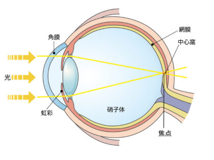 屈折異常（近視・遠視・乱視）と不同視の見え方の違いとは？｜渡部眼科