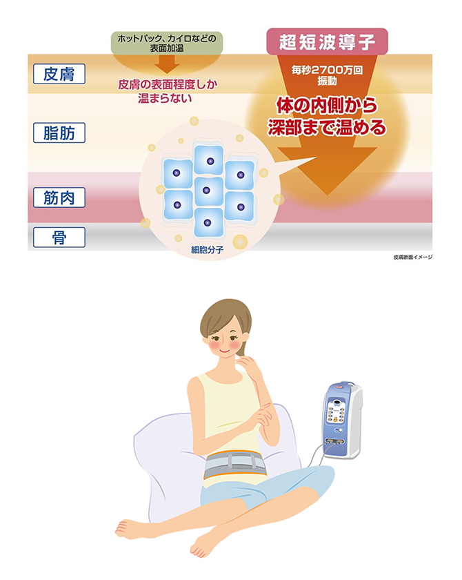 超短波とは？ | 伊藤超短波 一般のお客様向けサイト