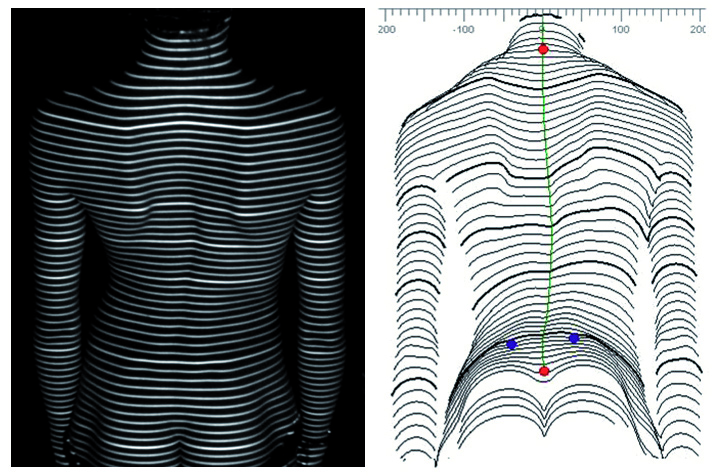 DIERS 4D Lab 姿勢・動的解析システム｜姿勢・動的解析システム｜医療