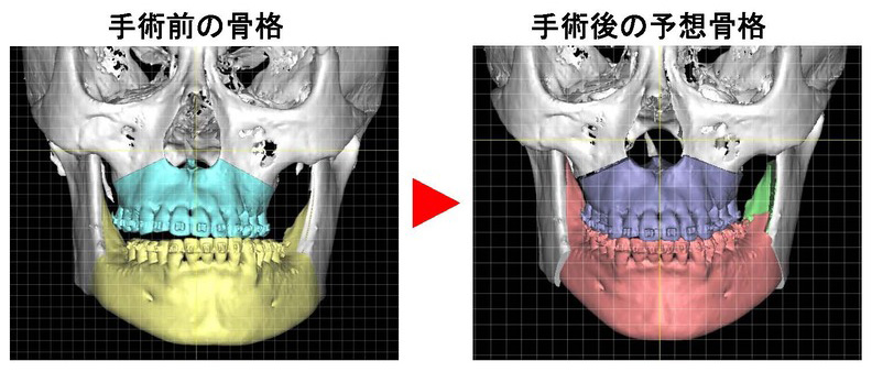 顎変形症センター | 総合東京病院【公式】中野区 練馬区 24時間救急受入