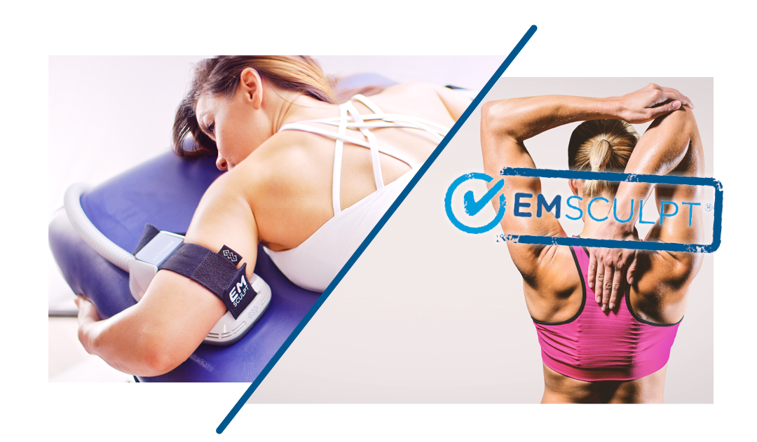 痩身治療器「エムスカルプト（医療EMS）」の減量効果 ｜東京都練馬区の