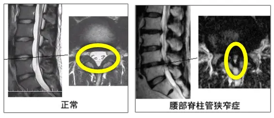 脊椎・脊髄 | 東京西徳洲会病院