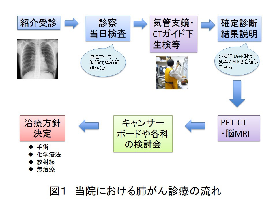 肺がんに対する最新の薬物療法について | 呼吸器内科 | 診療の最前線
