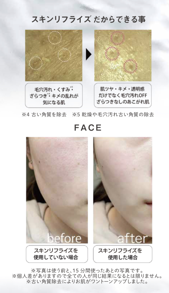 スキンリフライズ 超音波美顔器 ｜ 株式会社 タクサム｜大阪の美容