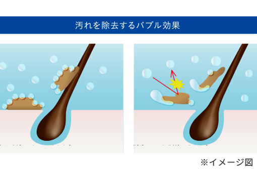 Truecare sure | メニュー対応機器 | 製品情報 | タカラベルモント