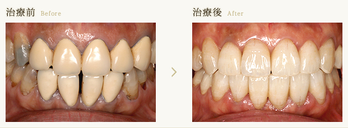 審美修復治療｜奈良市・生駒市の歯医者｜帝塚山歯科