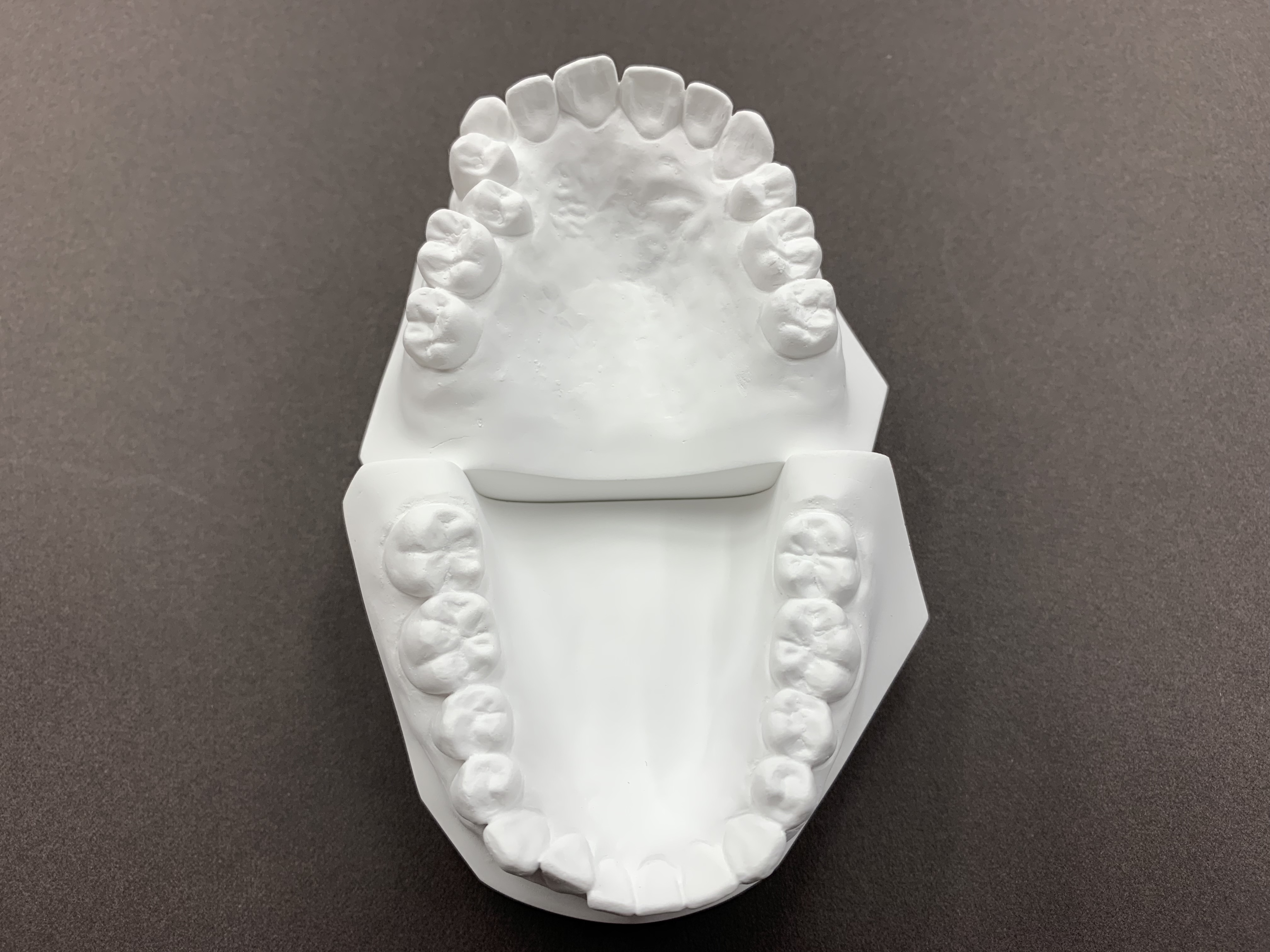 ストレートワイヤーエッジワイズシステムの臨床 | ブログ | 羽村市