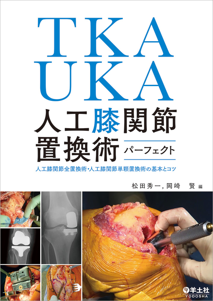 TKA・UKA 人工膝関節置換術パーフェクト〜人工膝関節全置換術・人工膝