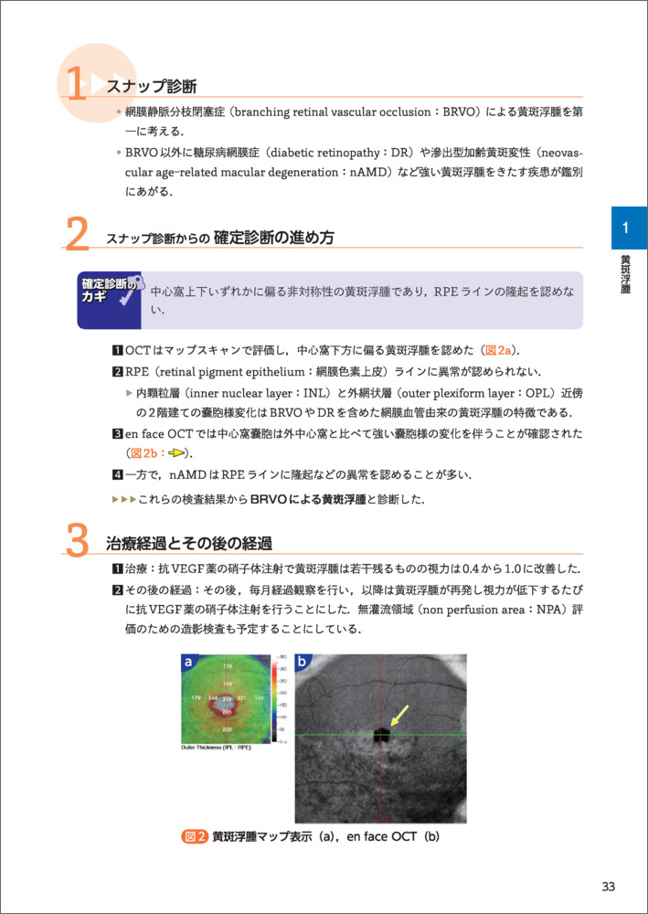 診断力がアップする！OCT・OCTAパーフェクト読影法〜正常・異常所見の